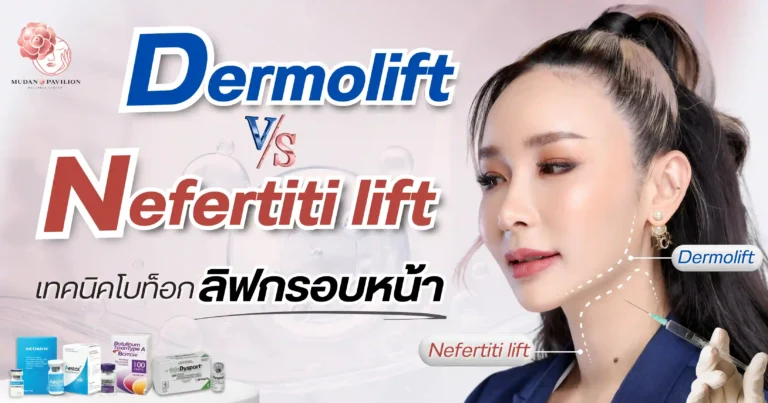 Dermolift-Nefertiti-lift