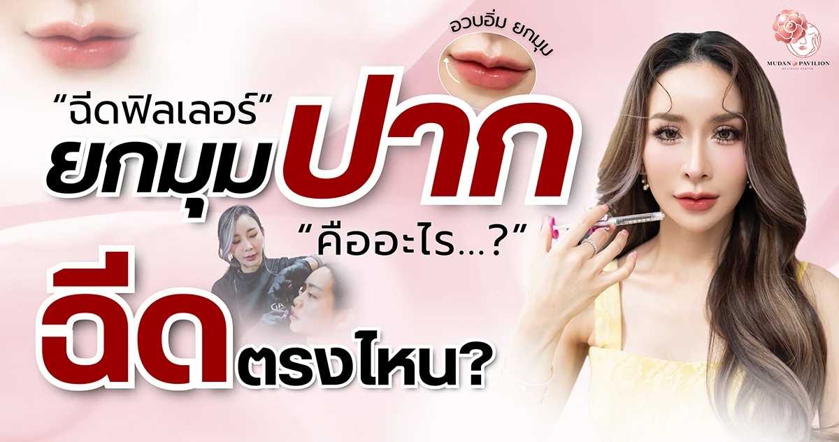 ฟิลเลอร์ยกมุมปาก คืออะไร ? ฉีดตรงไหนและอันตรายไหม